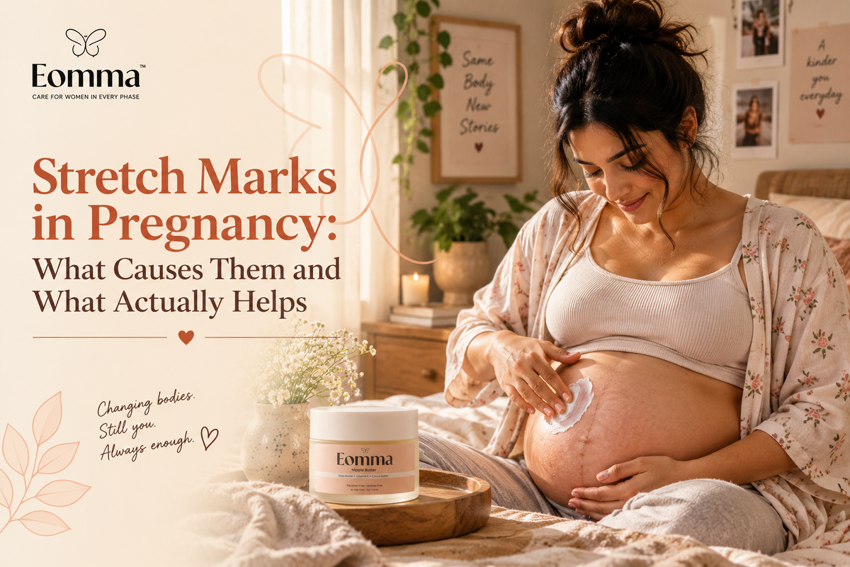 Stretch Marks in Pregnancy: What Causes Them and What Actually Helps
